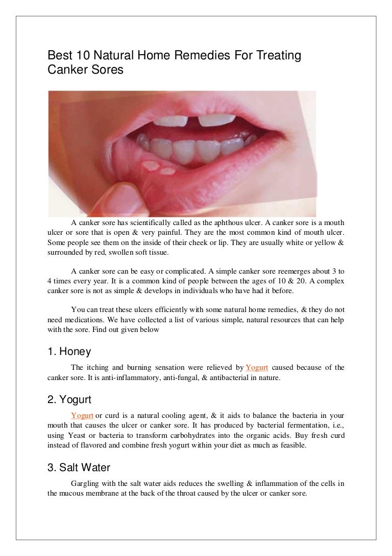 Communication on this topic: Honey Heals Canker Sores, honey-heals-canker-sores/ Forum on this topic: Honey Heals Canker Sores, honey-heals-canker-sores/